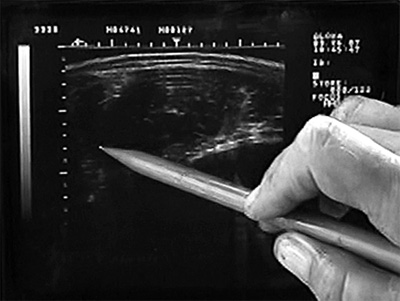 beef ultrasound