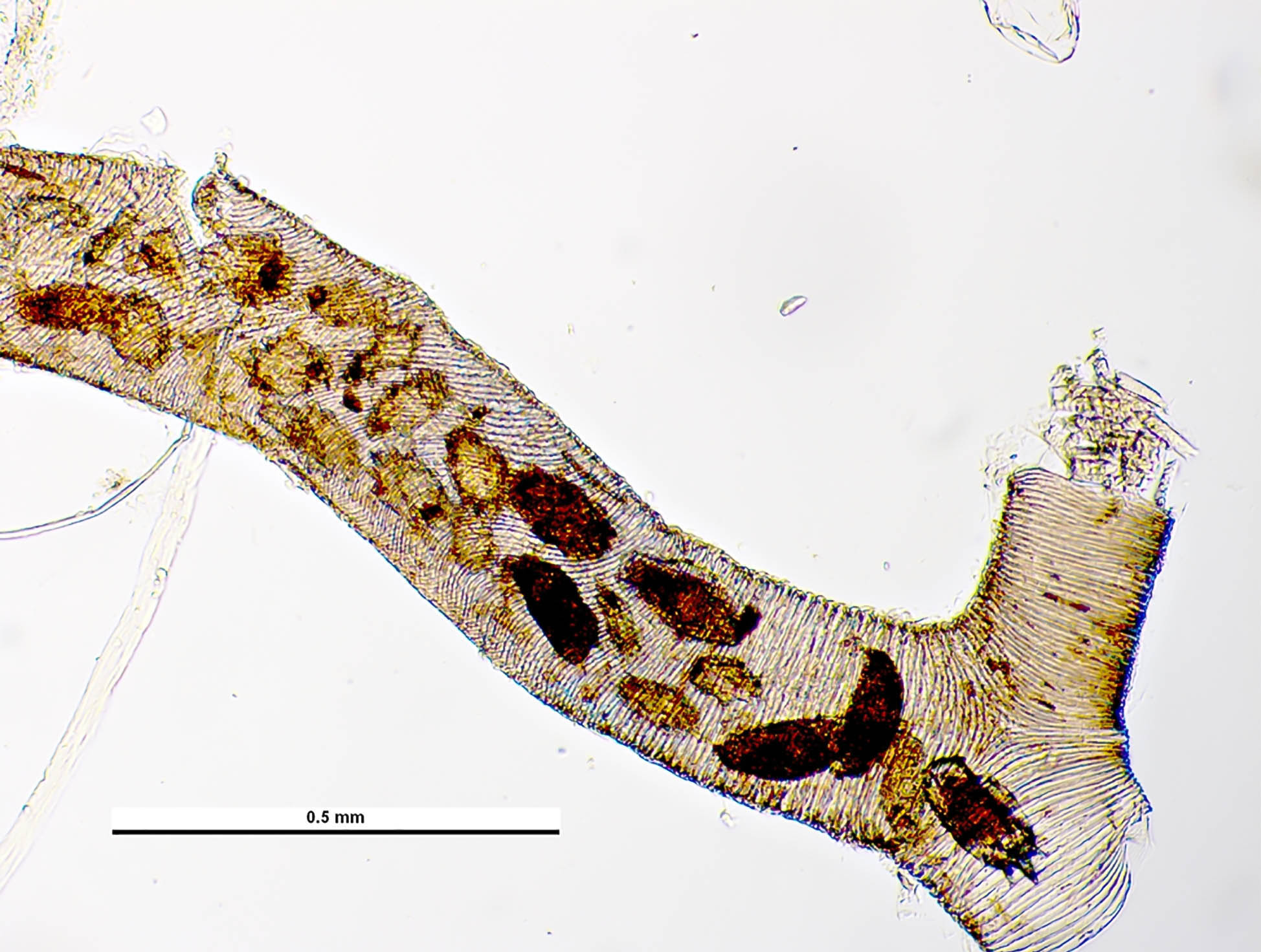 The image shows a honey bee's trachea under a microscope, heavily infested with tracheal mites (Acarapis woodi). The mites appear as dark, oval-shaped organisms clustered inside the tracheal tubes, feeding on the bee's hemolymph. The damage to the tracheal lining is visible, with the mites obstructing the airways, potentially leading to respiratory distress and weakening the bee colony.