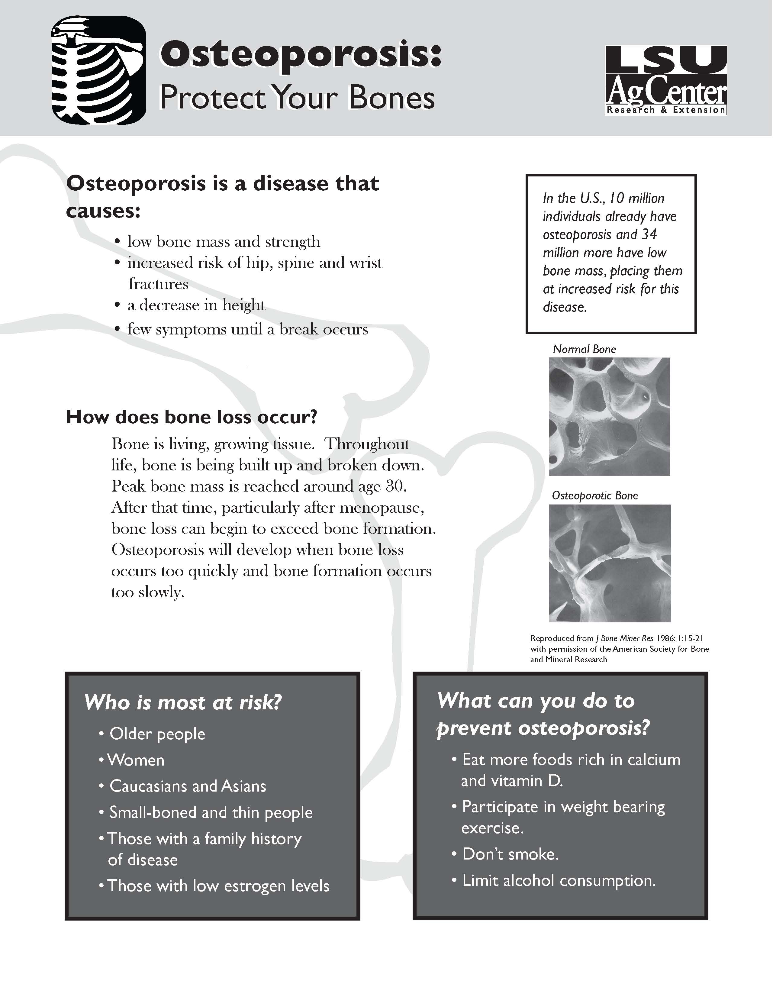 Osteoporosis:  Protect Your Bones