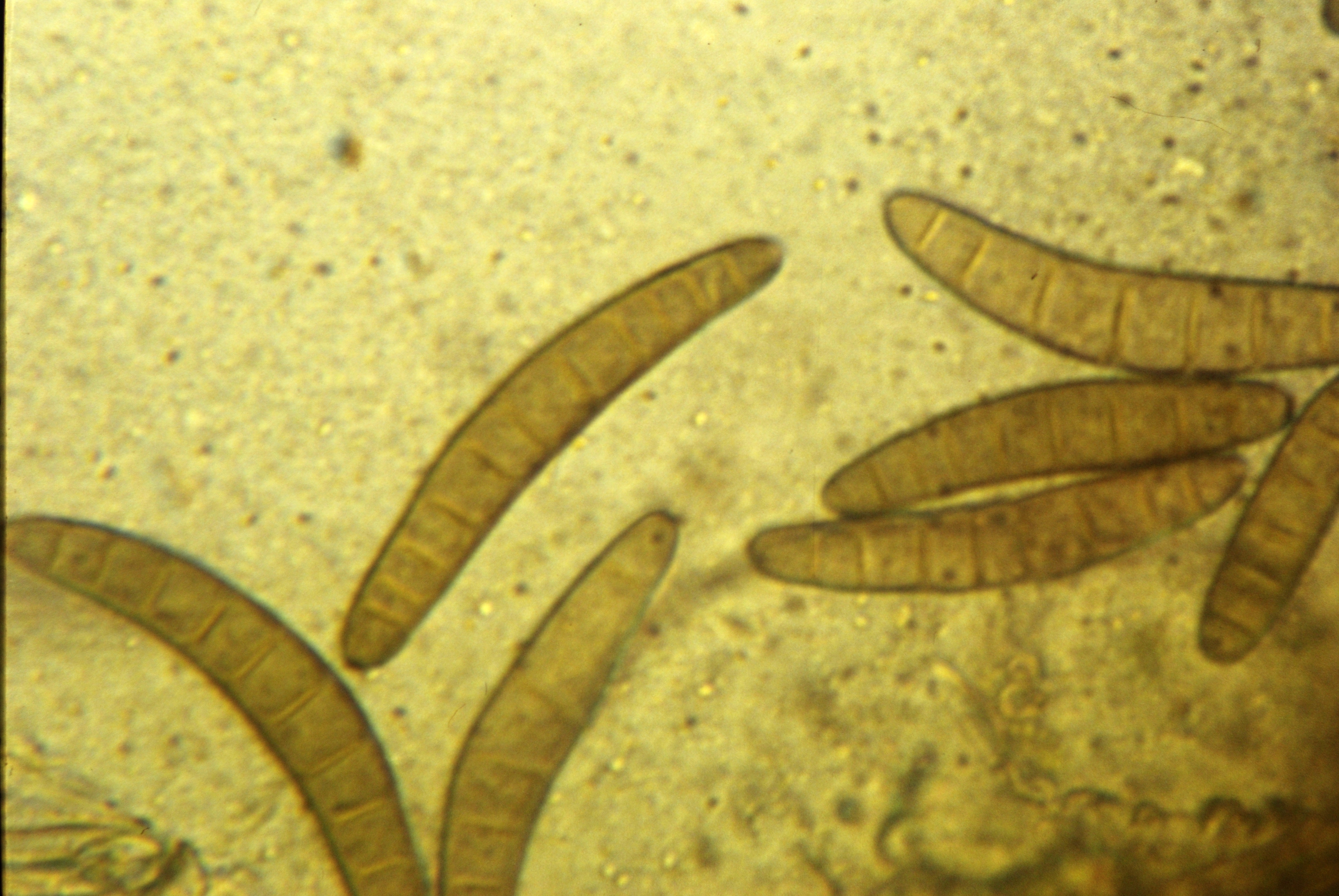 Cochliobolus Miyabeanus
