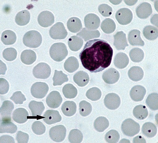 The rickettsial bacterium Anaplasma centrale infecting red blood cells of a cow. Arrow points to typical infected cell.