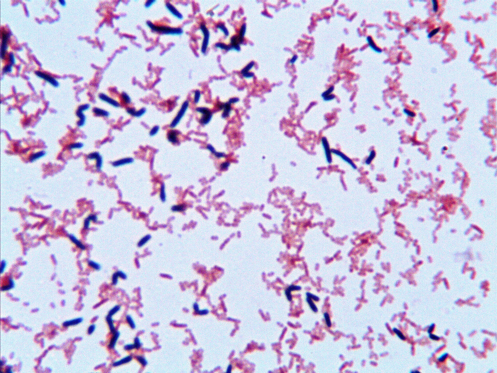 Micrograph of Burkholderia Glumae