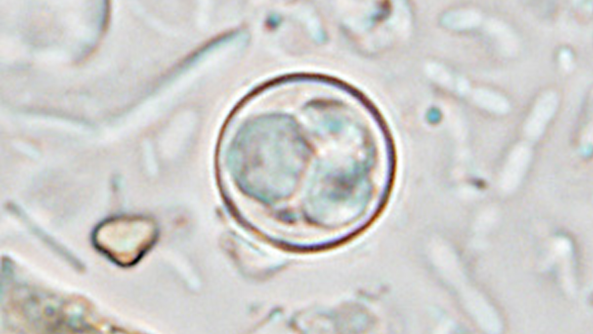 Microscopic image of a parasite 