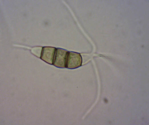 A microscope magnification of a plant pathogen. 