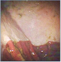 Equine Gastric Ulcer Syndrome (EGUS)