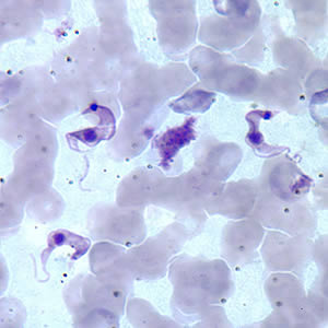 Blood smear through a microscope