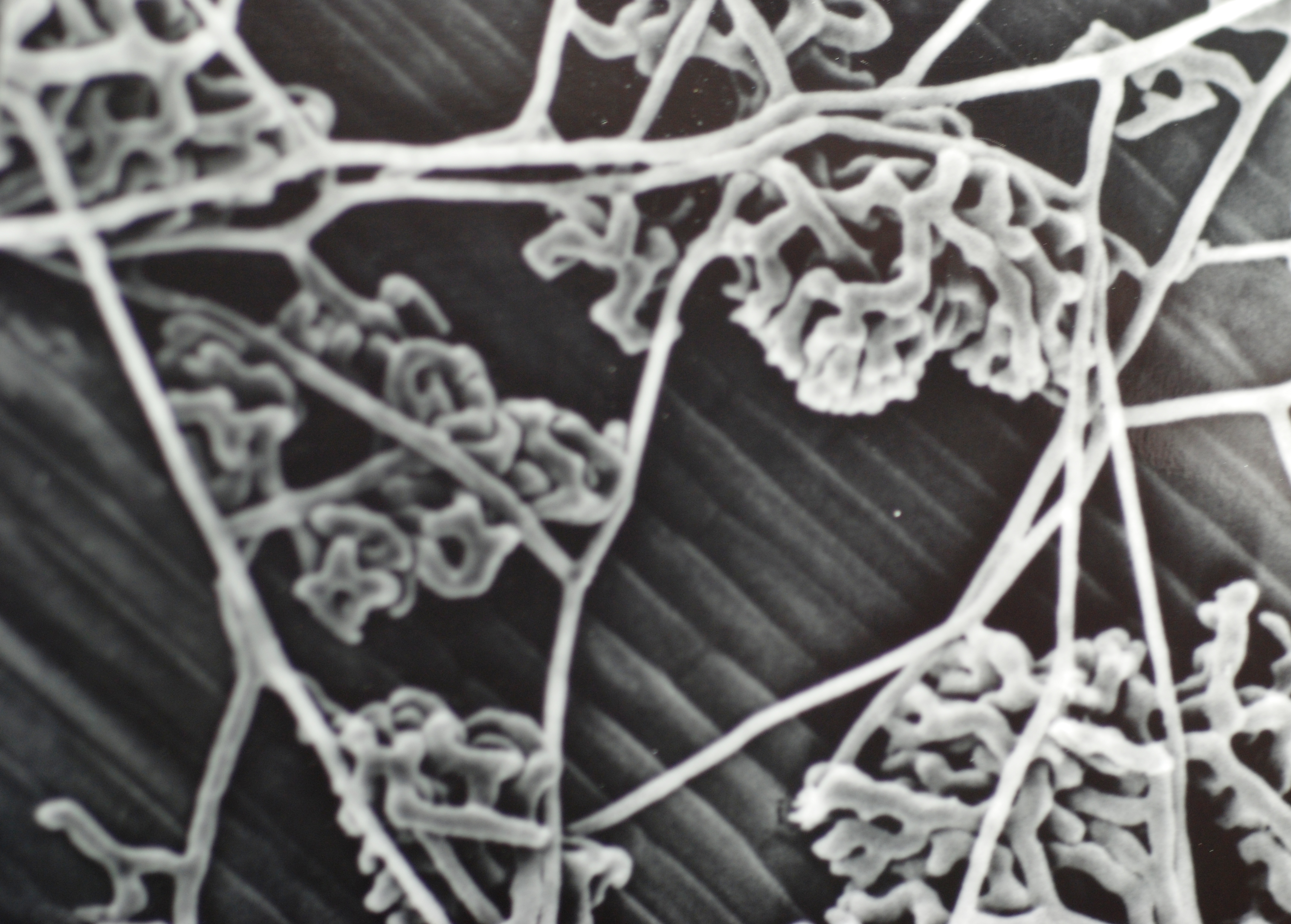 Electron Micrograph of Rhizoctonia Solani Mycelium